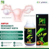 Obat Kista Paling Ampuh Tanpa Operasi Kista Bartholin Kista Ovarium Kista Di Rahim Kista Ginjal Benj