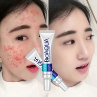 Ance Treatment 30g Rejunevation cream Ance Removal Anti Scar Shrink Pores Nourish Skin Krim jerawat