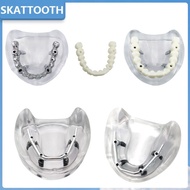Dental Implant Model with Overdenture Restoration Teeth Upper Jaw Tooth Removable Implant Model for 