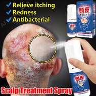 Seborrheic Dermatitis Spray Scalp Treatment Ubat Kulit Kepala Berkuping Scalp Psoriasis Itchy Scalp 