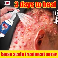 Japan scalp treatment spray seborrheic dermatitis ubat gatal kulit kepala itchy scalp spray for Psor