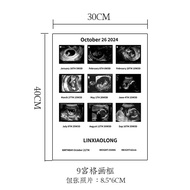 Maternity B-Scan DIY Baby 4D Ultrasound Photo Growth Solid Wood Frame Newborn Birth Memorial Gift Re