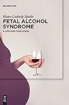 Fetal Alcohol Syndrome: A lifelong Challenge