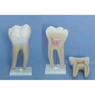 Free Shipping Big Molar Model (Two Pieces) Dental Anatomy Model Oral Care Model Dental Anatomy Model