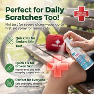 Skin Injury Repair Spray Quickly Stop Exudate Promote Scab Formation Shorten Recovery Time
