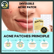[288Pcs] Invisible Acne Patch Tea Tree Oil Acne Repair | Pimple Patch Acne Scar Acne Treatment Stick