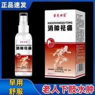 Legs Hands Swelling Relieving Pain Relief Spray Sedentary Sitting Feet Swelling Legs Foot Edema Elde