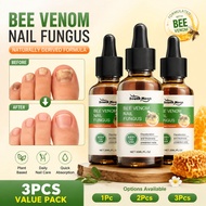Advanced Bee Venom Nail Solution 30ml - Urea & Benzalkonium Chloride For Fungus & Nail Health Care A