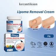 South Moon Lipoma Removal Cream Natural Herbal Extracts Lipolysis Fat Lump Subcutaneous Lumps Skin S