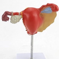 Ryanong Female Ovary Model, Uterine Pathological Anatomy Model, Removable Reproductive Cervix Ovary