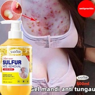Sulfur Acne Removing Shower Gel Anti Mite Itching Shower Gel 500Ml Whitening Acne Removing Itching a