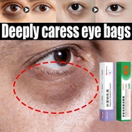 ✨Soochen's Sodium Heparin Cream - Dark Circles & Eye Bags Reducer Moisturizing Repair Dry Peeling Ey