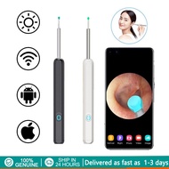 ไม้แคะหู กล้อง ที่แคะหูกล้อง	WEILAN ที่แคะหู พิกเซล1000W ไม้แคะหูอัจฉริยะ ลิงค์ wifi พร้อมช้อนหู 4 อ