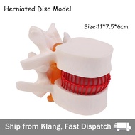 【READY STOCK】Implant Teeth Practice Model/4 Times Teach Analysis Crown Bridge/Tooth Preparation Mode