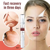 Fast-Acting Herbal / Wart Remover Pen / Genital Warts Treatment / Skin Tag Remover / Strong Repair /