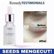 Remedy Luminous Serum/ Young and Flawless Skin / Remove Oil Seed, Milia Seed / Instant Glowing