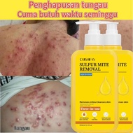 3-in-1 Sulfur Body Wash 300ML Acne&Eczema Care,Whitening Shower Gel Sulfur cleansing Mite removal,It