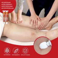 LEG EDEMA CREAM Krim urutan edema anti bengkak Melancarkan peredaran darah krim edema kecutkan edema