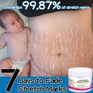 Strech Mark Cream-Stretch Mark Cream- stretch mark 150g natural herbs Repair Stretch Mark Anti Stret