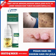 Obat Untuk Penghilang Segala Macam Kutil Kelamin Papiloma Kutil Di Kulit Kutil Daging Kutil Vagina P
