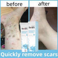 Scar removal cream/Acne scar/ Scar gel 15g Old Scar removal Skin repair