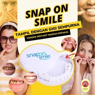 Veneer Vener Gigi Snap On Smile Perawatan Kesehatan Gigi Palsu Renggang Snapon Smile 1 Set