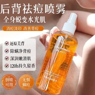 背痘消】身体去后背青春痘前胸痘控油去痘印粉刺疏通毛孔260530 Back Acne Remover】Body acne remover for back and chest, oil control
