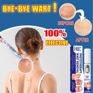 Wart removal therapy laser pen warts remover device kulugo remover unisex