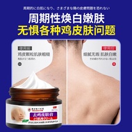 Remove Chicken Skin Care Cream Leg Arm Fish Scale Rough Chicken Skin Goosebumps Remove Chicken Skin 