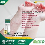 Obat Biduran Alergi Dingin Kulit Gatal Bentol Bruntusan Kaligata Di Tangan Kaki Gatal Menahun dengan