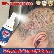 Seborrheic Dermatitis Spray 30ml Scalp Treatment Scalp Psoriasis Anti Dandruff Ubat Kulit Kepala Ber