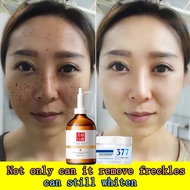 whitening cream - dark spot remover - freckles removal cream 50g Both whitening and freckle removal Suitable for all ages 美白祛斑霜