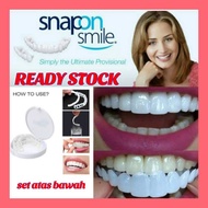 Gigi Palsu(snap on smile)
