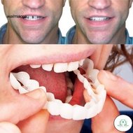 GD Snap On Smile gigi palsu 1set atas bawah Instant Charming Smile Removable Veneers RB-Dentistry Pe