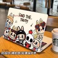 Macbookair Protective Case 50cm Frosted Transparent Protective Case macbookpro14 m4Air13.6 Apple Not