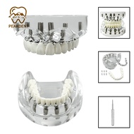 Dental Lower/maxilla Tooth Implant Model Overdenture Teeth Removable Implant Model for Researching M