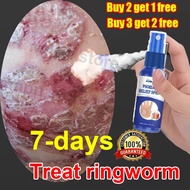 ubat gatal kulit 50ml ubat kurap obat gatal untuk kulit itchy skin psoriasis Spray ubat kudis gatal