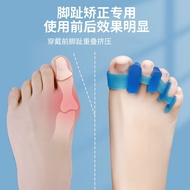 A/💎Toe Rectifier Toe Separator Separator Curved Overlapping Size Two Thumb Valgus Five Finger Toe Cover Wearable Shoes F