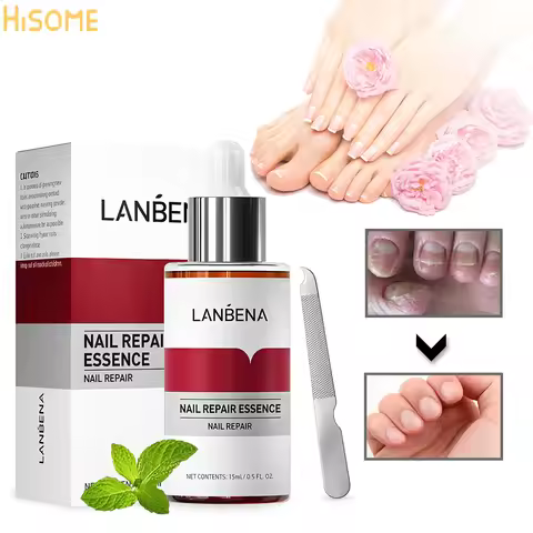 LANBENA Fungal Nail Treatment Feet Care Essence Remove Onychomycosis Toes Nourish Brighten Hand Feet