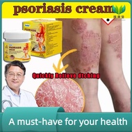 kesihatan ♥Psoriasis Cream Antifungal cream Eczema cream Cream gatal kulit 20g krim gatal kulit herb