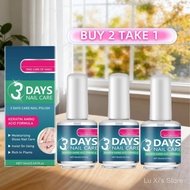 SG Spot goods  BUY 2 TAKE 1 3 Days Nail Care Nail Care Solution Gentle care and moisturizing treatme