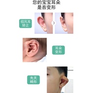 Ear Fixing Sticker Baby Style Ear Corrector Medical Silicone Auricle Correction Sticker Tape Newborn