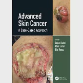 Advanced Skin Cancer: A Case-Based Approach