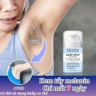 Skin whitening cream Dark Armpit cream bikini intimate whitening cream 50g Nourishes and regenerates