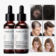 [KL PHARMACY] serum rambut gugur Minyak Lebatkan Rambut Rosemary oil air Tonic Hair Growth Serum Hai
