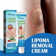 Lipoma Cyst Removal Cream Magical Lipoma Elimination Ointment Instant Lipoma Removal Balm Herbal Lip