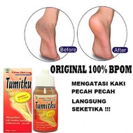 Obat Rorombeheun Kaki Cream Tumit Pecah dan Kering Parah