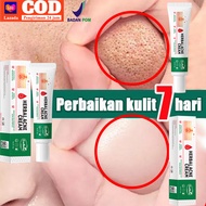 BPOM HERBAL ACNE CREAM-penghilang jerawat dan bekas/cream pemutih waj glowing/krim penghilang flek h