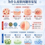 Miaoyouning Antibacterial Cream Anti-Itch Cream Anti-Itch King Anti-Itch Cream Mosquito Bites Anti-I