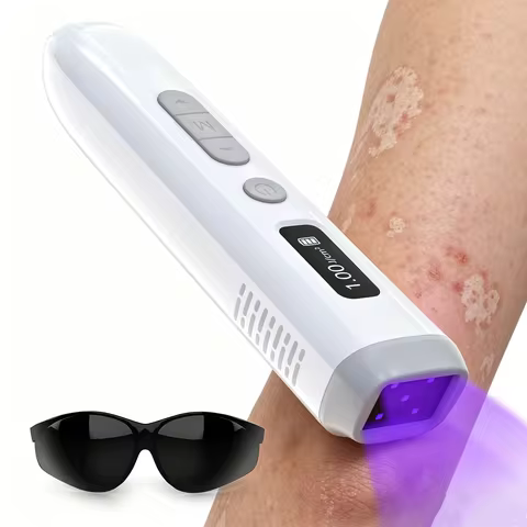308nm UVB Vitiligo Lamp Handheld Narrow Spectrum Ultraviolet Light Therapy Device for Psoriasis Ecze
